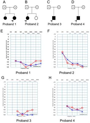 Identification of four novel variants in the CDH23 gene from four affected families with hearing loss